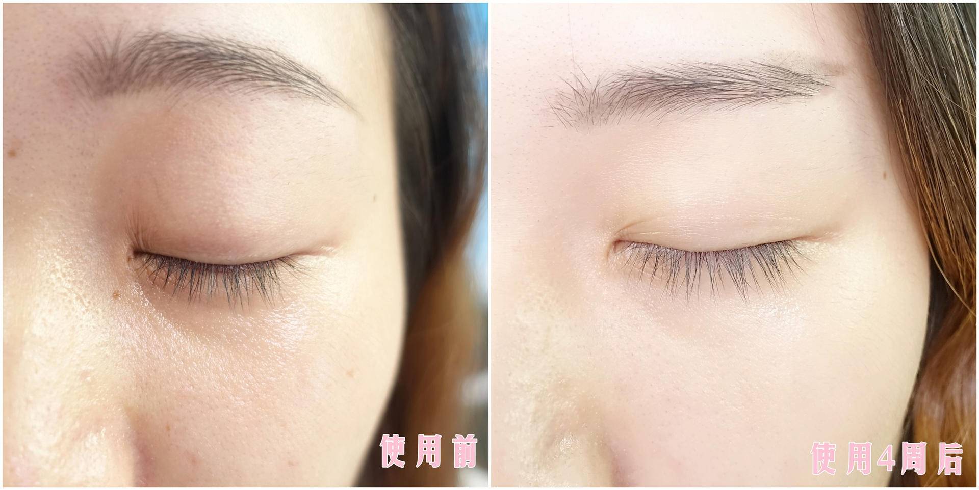 olay淡斑小白瓶如何正确使用,olay玉兰油小白瓶精华好用吗