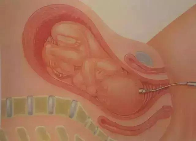 孕妈怎么发现自己怀孕的,新手孕妈怎么推算自己怀孕几天