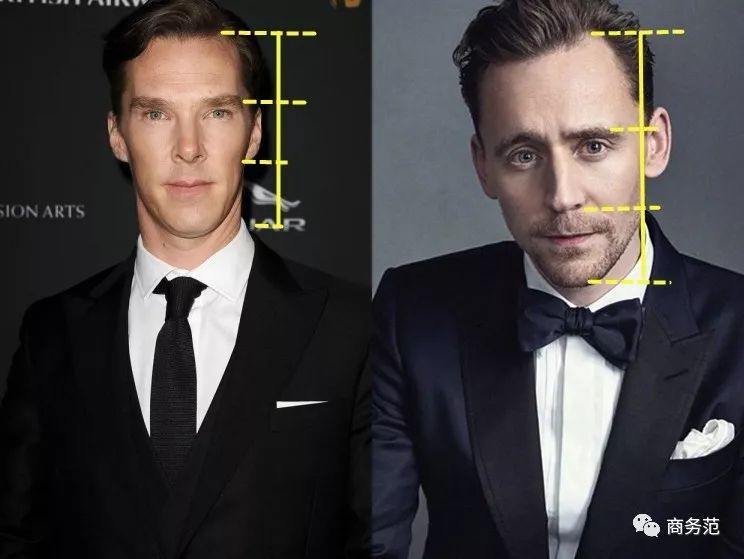 威廉王子秃顶了哈里为啥没秃顶,威廉王子为什么喜欢秃顶