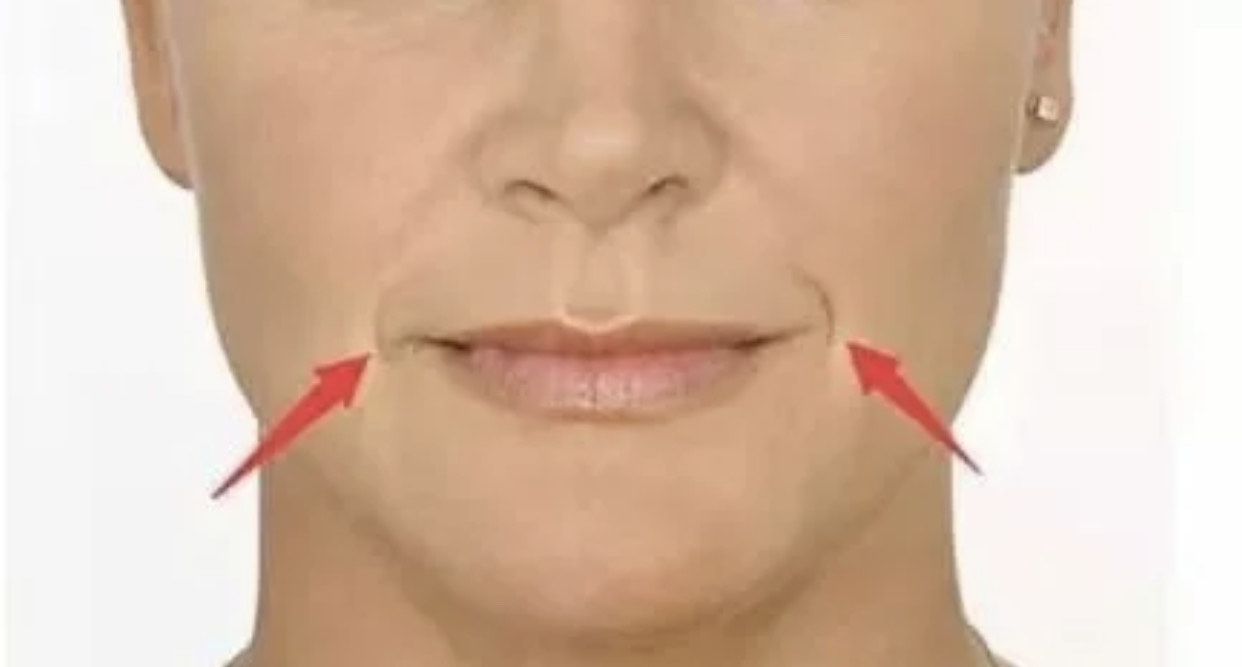 面无表情和爱笑哪个容易长皱纹,一笑眼下有皱纹怎么办