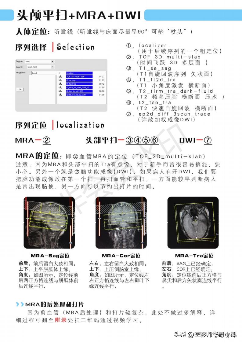 磁共振扫描技术西门子,西门子磁共振最新操作界面