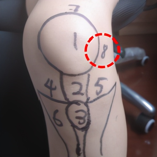 膝盖痛12种疼痛对照表图解,不同部位膝盖疼痛的原因