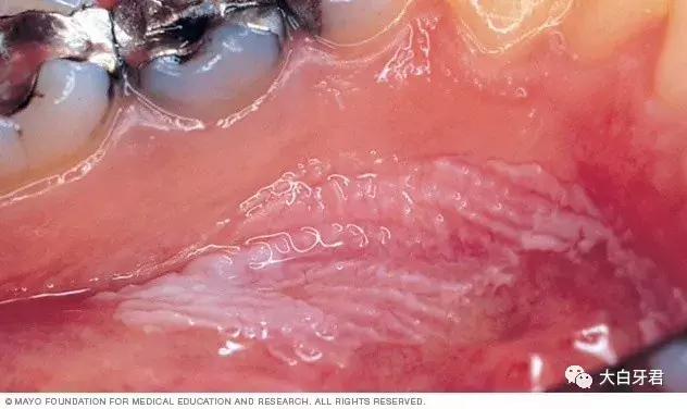 为了您健康远离槟榔,千万别乱吃槟榔