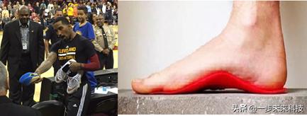 足球黑科技定制鞋垫,生物力学鞋垫价格