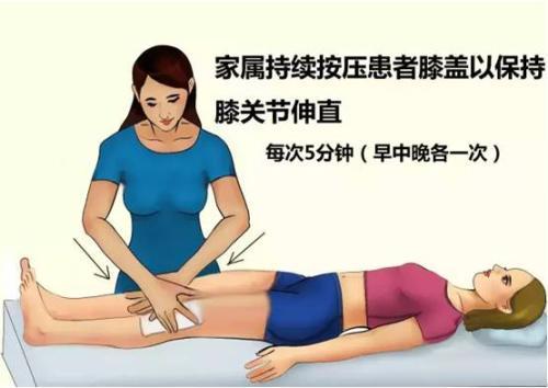 膝关节置换四十天应该怎样康复,膝关节置换术后两周内康复过程