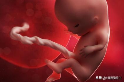 免疫不良妊娠是什么意思,免疫导致不良妊娠怎么干预