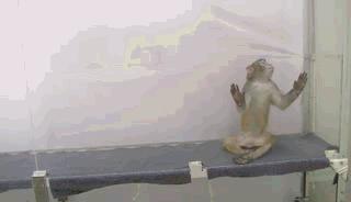 脊髓损伤将不再是不治之症,脊髓损伤手不能动能治愈吗