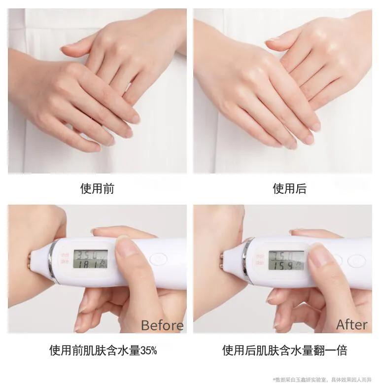 天气干燥手指角化皲裂,洗手频繁干裂脱皮用什么药