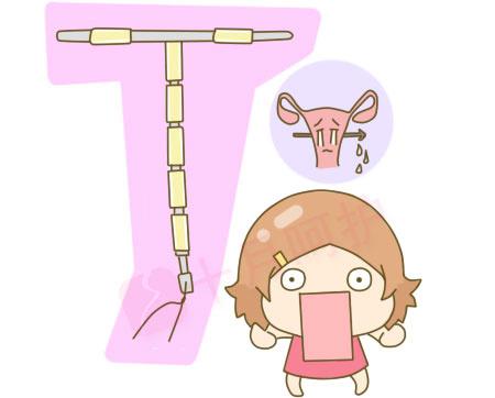 女性避孕方式有几种方法,未婚女性避孕最佳方式