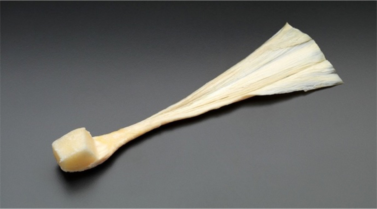 膝关节前交叉韧带修复后如何康复,前交叉韧带重建后膝盖发软