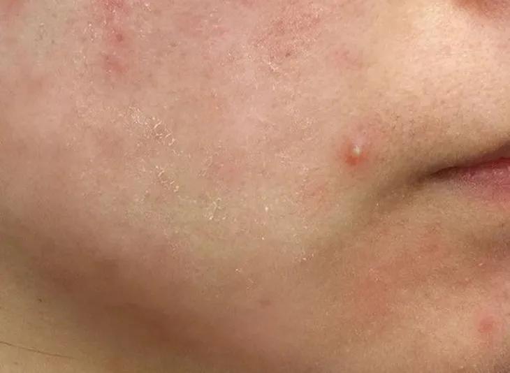 冷美人保湿精华,国货好物润肤保湿