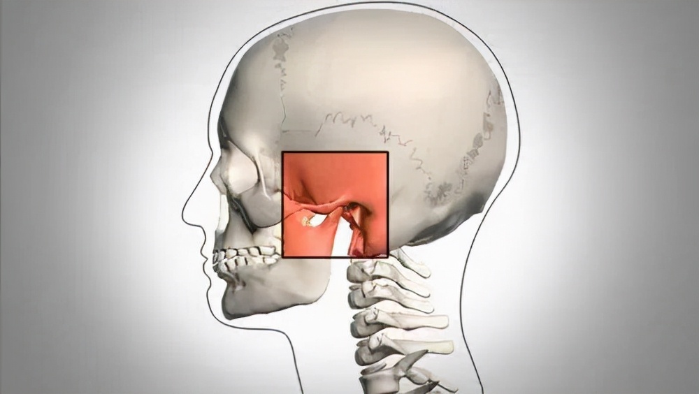 缺牙长期一侧咀嚼嘴巴倾斜,缺牙对咀嚼的影响