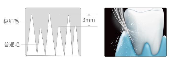 电动牙刷的原理及使用方法,看完这篇电动牙刷功能介绍