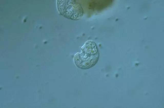 收藏!24种污水处理微生物菌相及指导意义,环保人必看(多图)