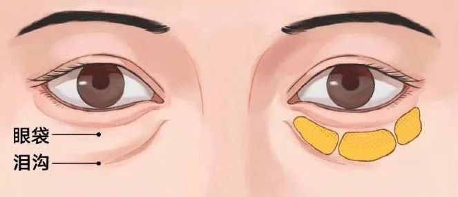 5分钟带你了解眼部问题，面对眼纹不惊慌，快来抄作业