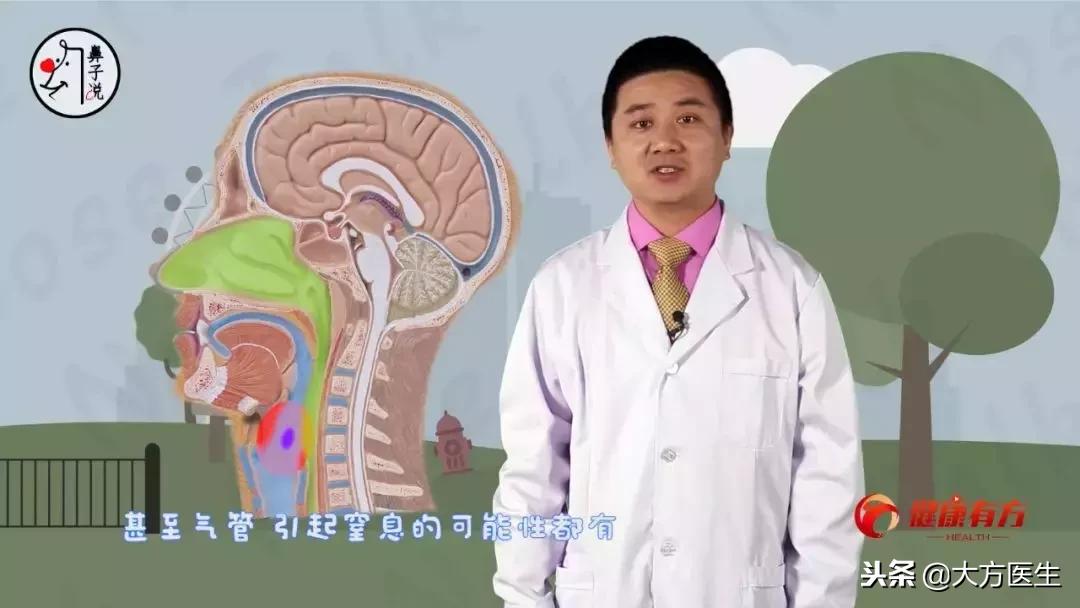 最好的方法清除鼻腔异物,鼻腔异物处理方法图片