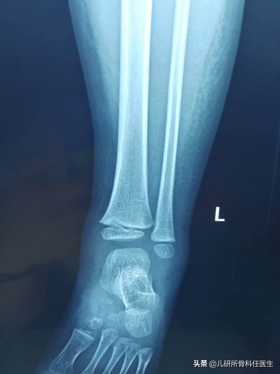 宝宝被蚊虫叮咬要怎么处理,宝宝被蚊虫叮咬试试这几招