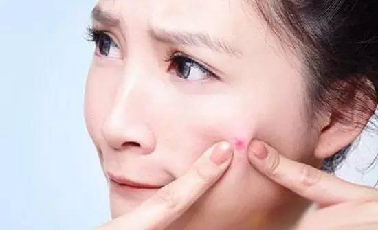 青春期长青春痘切忌吃什么,青春期长青春痘的治疗方法