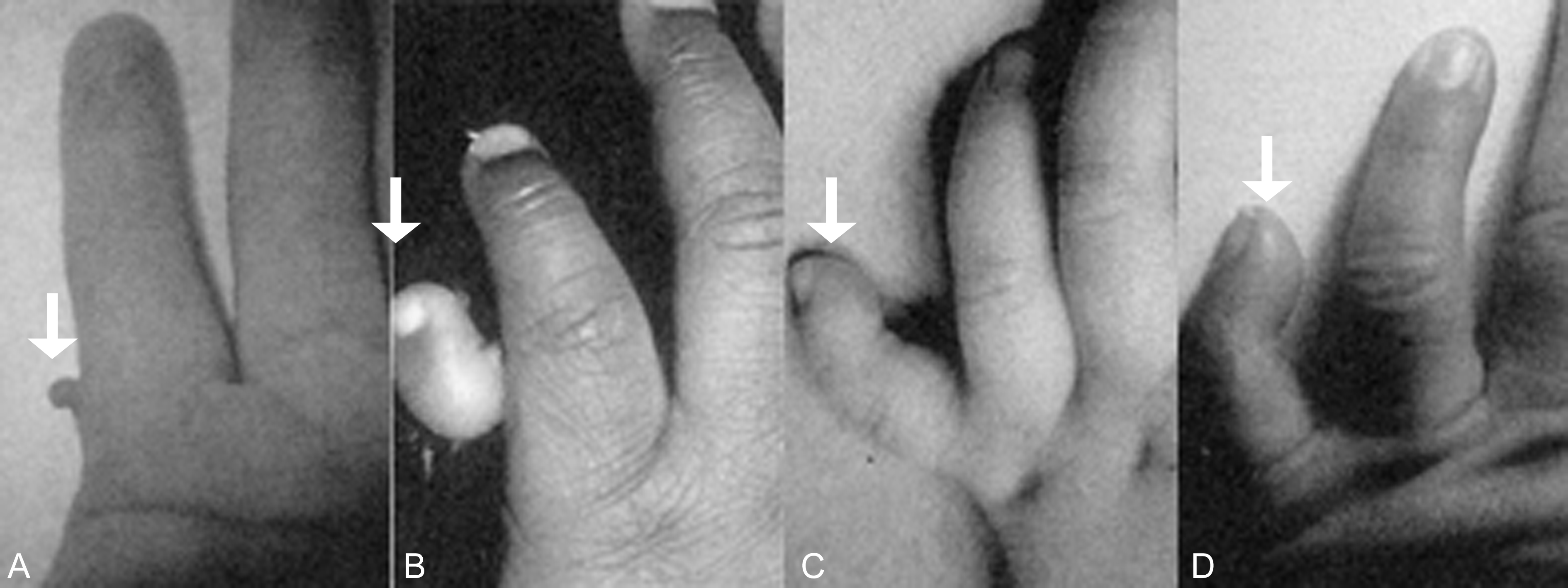 明明白白做b超,明明白白做超声