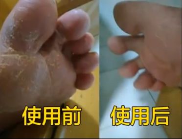 后脚跟干裂护足霜排行榜第一名,护脚霜脚后跟干裂修复霜国货