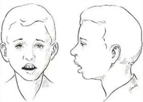 两岁还在用奶瓶,2岁还可以用奶瓶吗