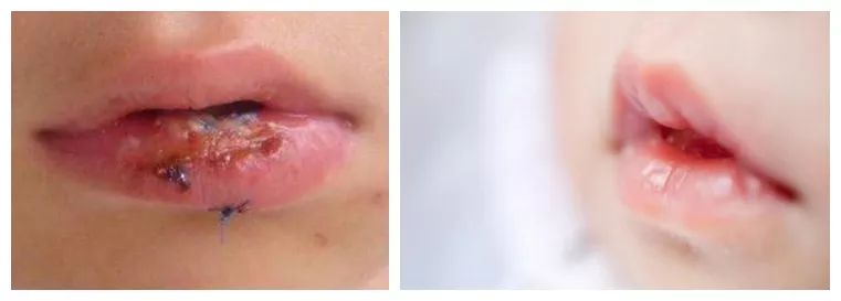 滋润保湿告别干燥起皮,保湿提亮肤色改善起皮防干裂