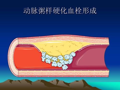 短裤穿久有什么危害,短裤穿太高有哪些症状