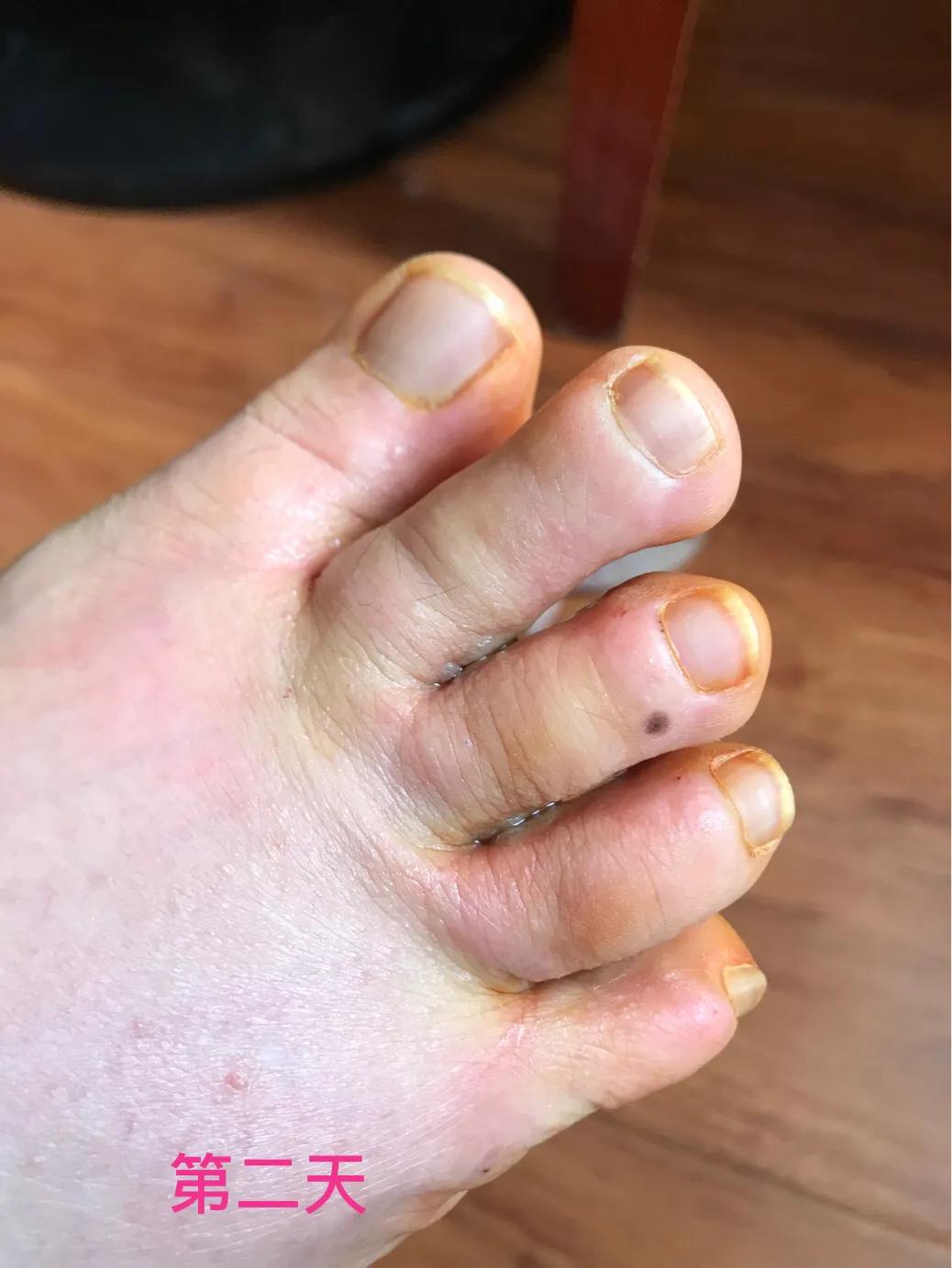 自己用中药熬的面膜靠谱吗,自己用中药做的面膜好吗