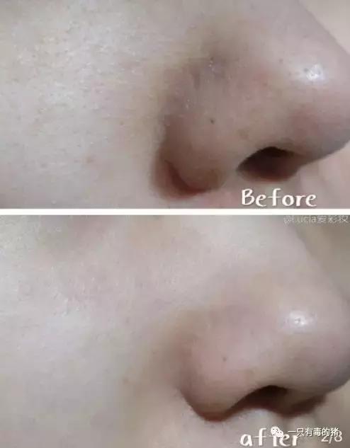 某书上火到不行的灌肤，是把我们的智商按在地上摩擦么