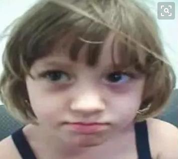 过敏性鼻炎眼袋发黑怎么去掉,过敏性鼻炎导致的眼袋怎么去除