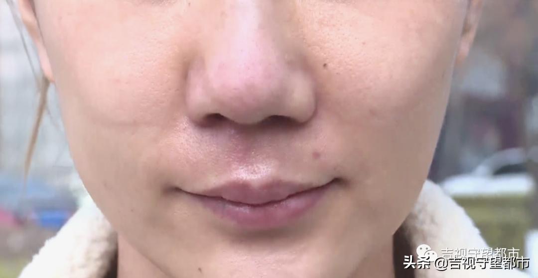 一万块可以做鼻综合吗,鼻综合半个月发现有点歪怎么办