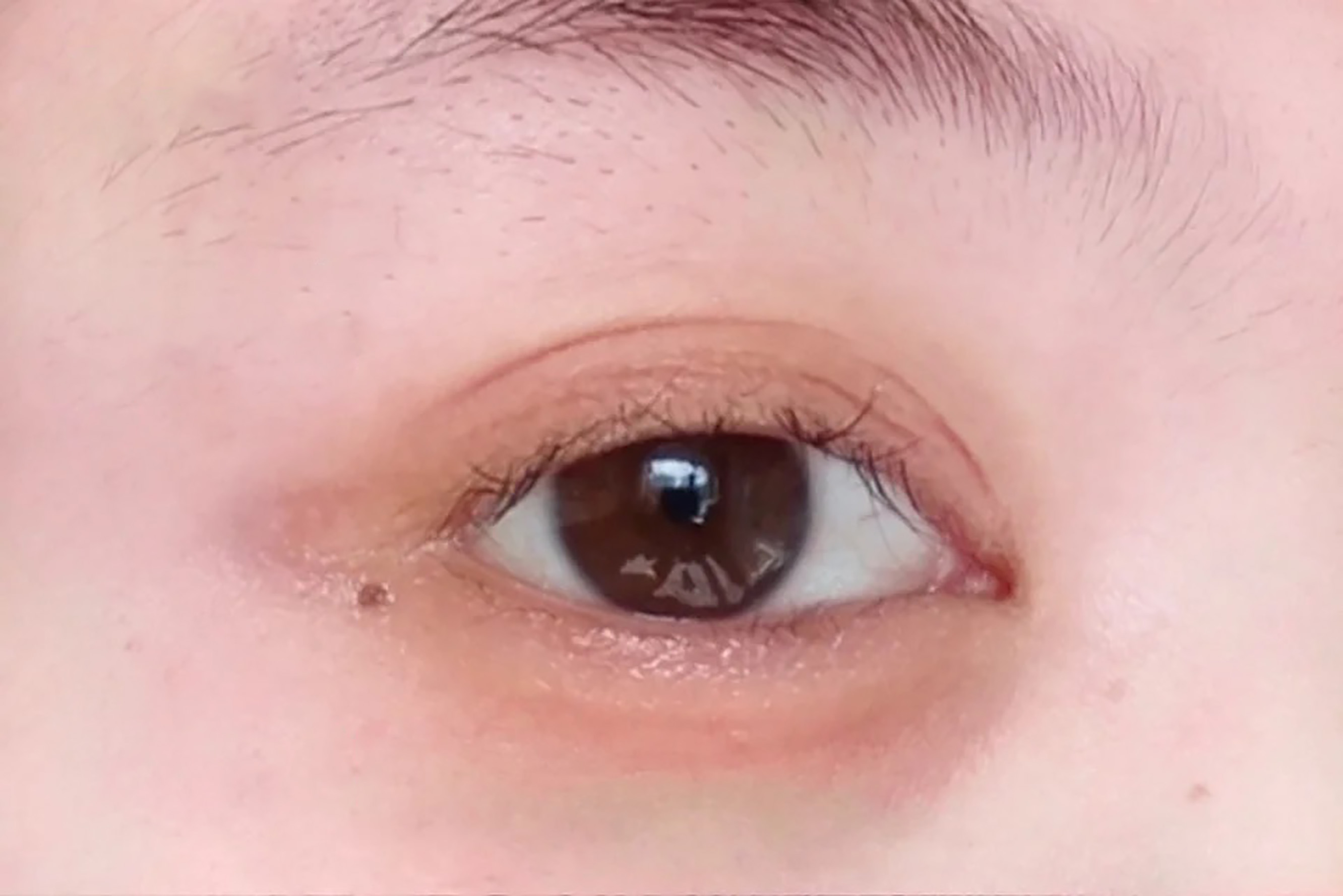 15秒了解眼睛有疾病,120秒轻松解决眼部问题