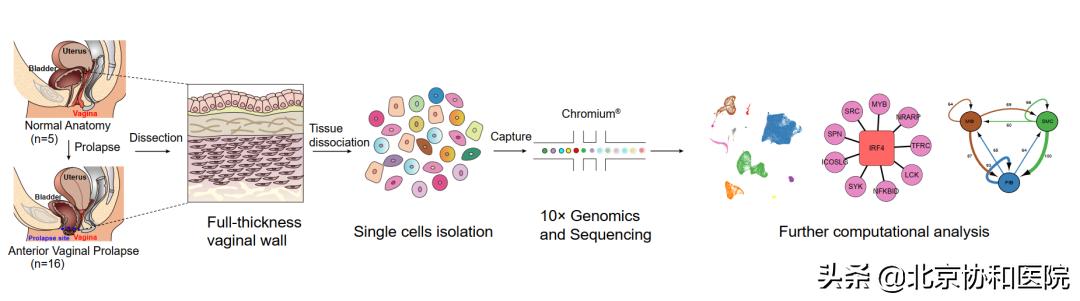 北京协和医院妇科朱兰视频,北京协和医院妇科专家朱兰