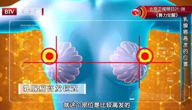 妇科病检查提前准备事项有哪些,常见妇科疾病的预防与自我检测