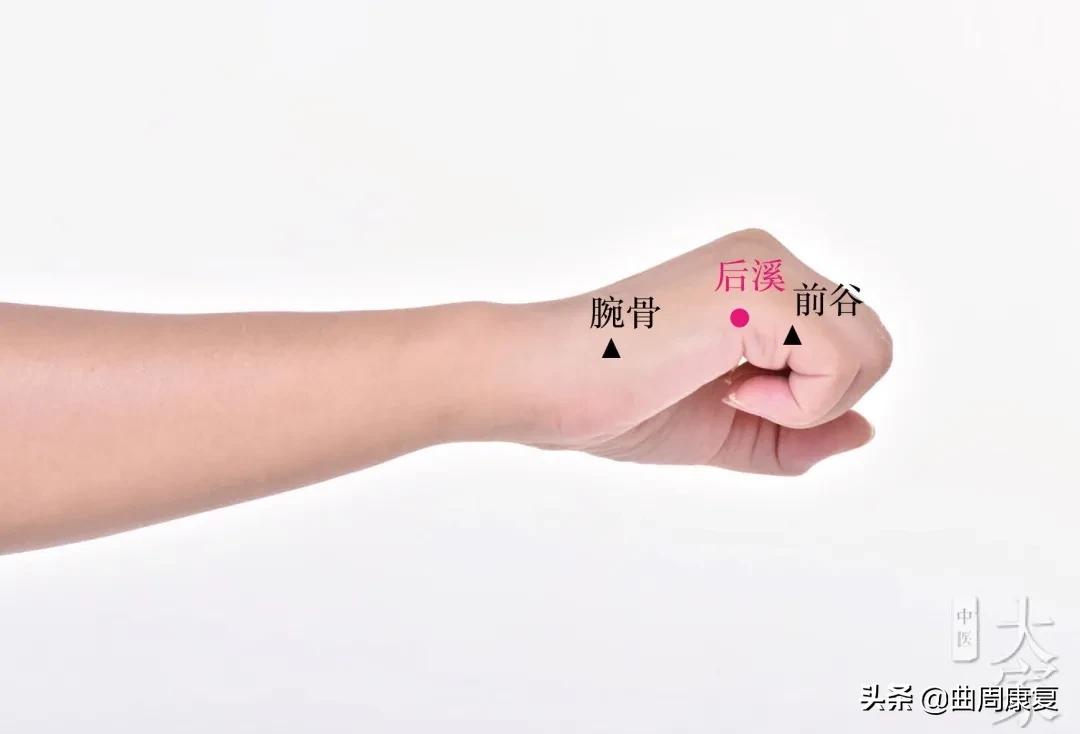 一针透两穴治愈落枕医案,针灸治疗落枕有奇效