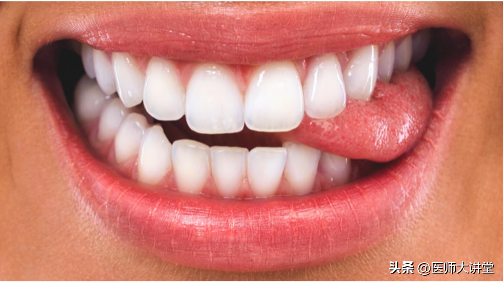 牙齿种植和口腔修复,口腔咨询牙齿矫正提问技巧