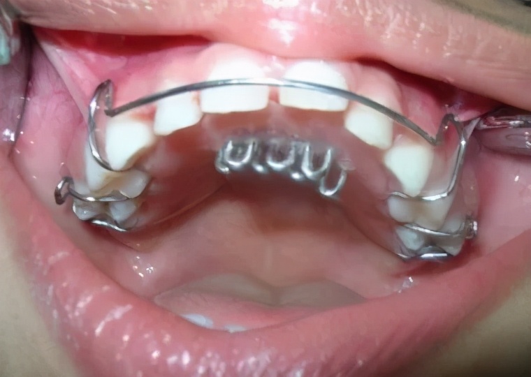 3岁小孩总吃手怎么戒掉,孩子四岁了还老是吃手怎么教育