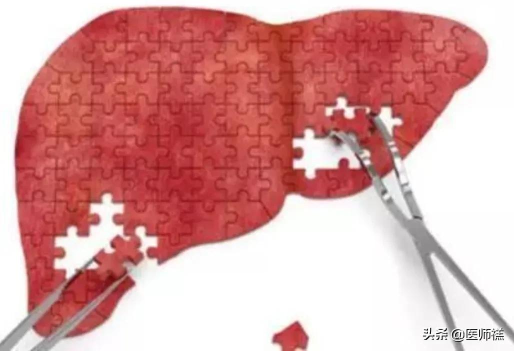 医生提醒阿托伐他汀的常见副作用,长期吃阿托伐他汀需要注意什么