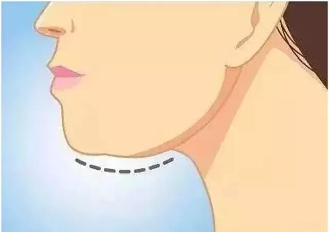 韦敏主任科普,韦敏技术团队科普