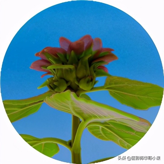 做完碘131检查后注意事项,碘造影剂的作用及使用