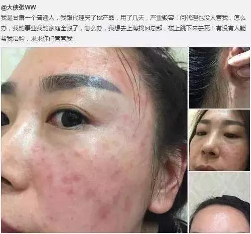 21亿智商税？屡遭质疑的微商面膜如此赚钱！林志玲陶虹都陷入了