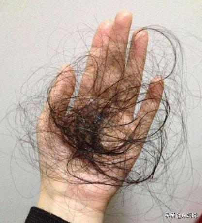 生娃之后掉头发是什么原因,生完宝宝1年掉头发是越来越严重