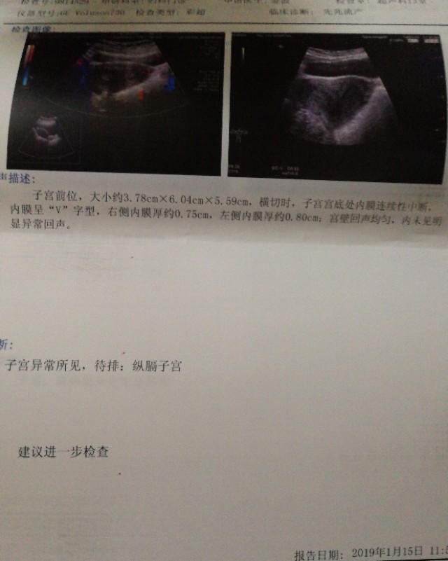 完全纵隔子宫流产在几周,子宫纵隔会导致流产吗