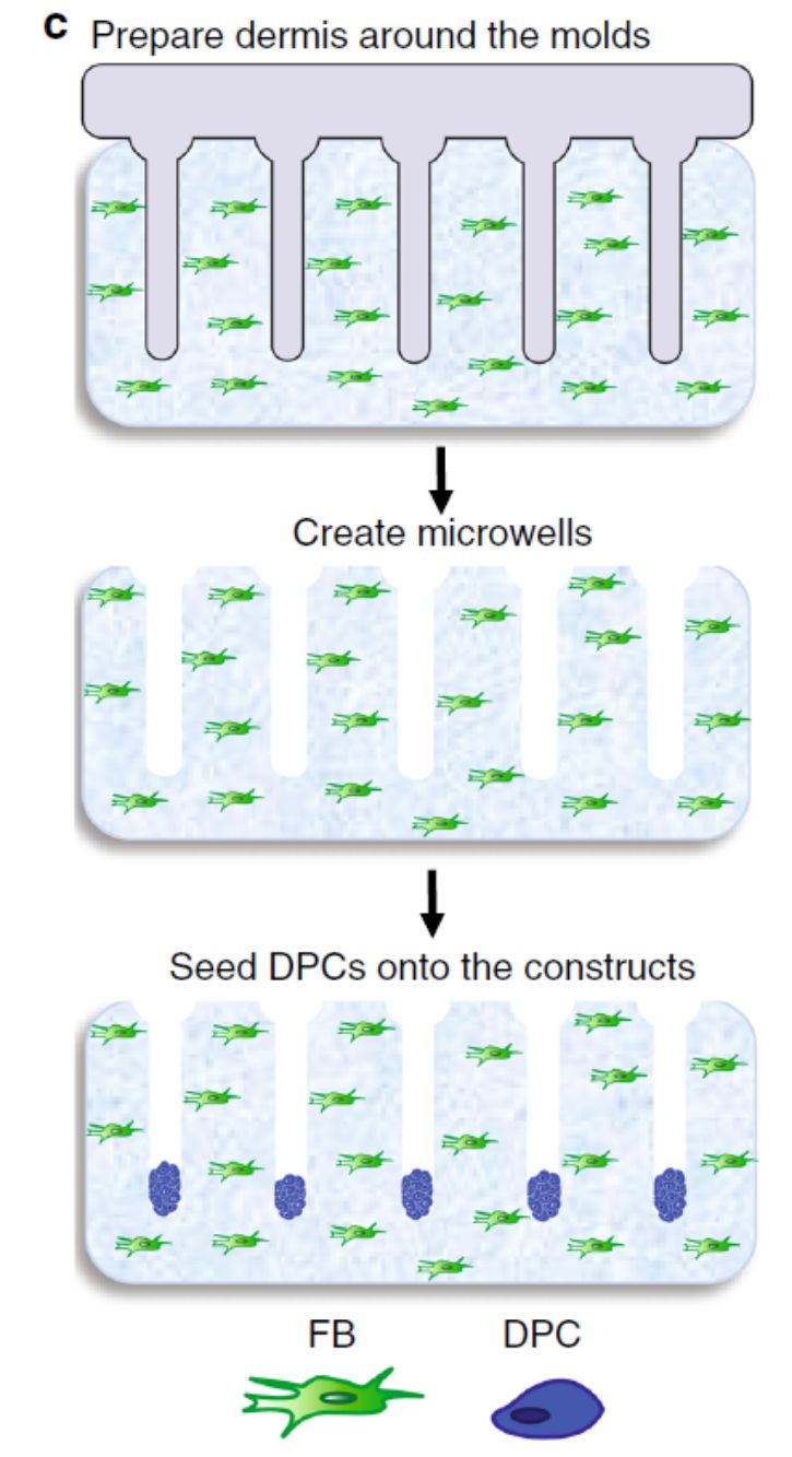 3d打印毛囊工厂,3d打印毛囊移植