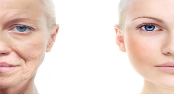 晒太阳过时啦，EPMO灼灸黑科技，脸蛋“嘭”的一下就年轻了