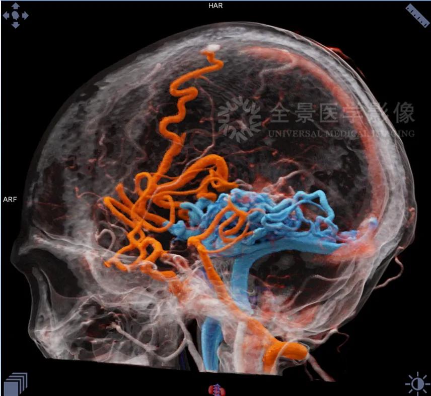 颈部肿块为什么有80%是肿瘤,颈部肿块1年没有变化