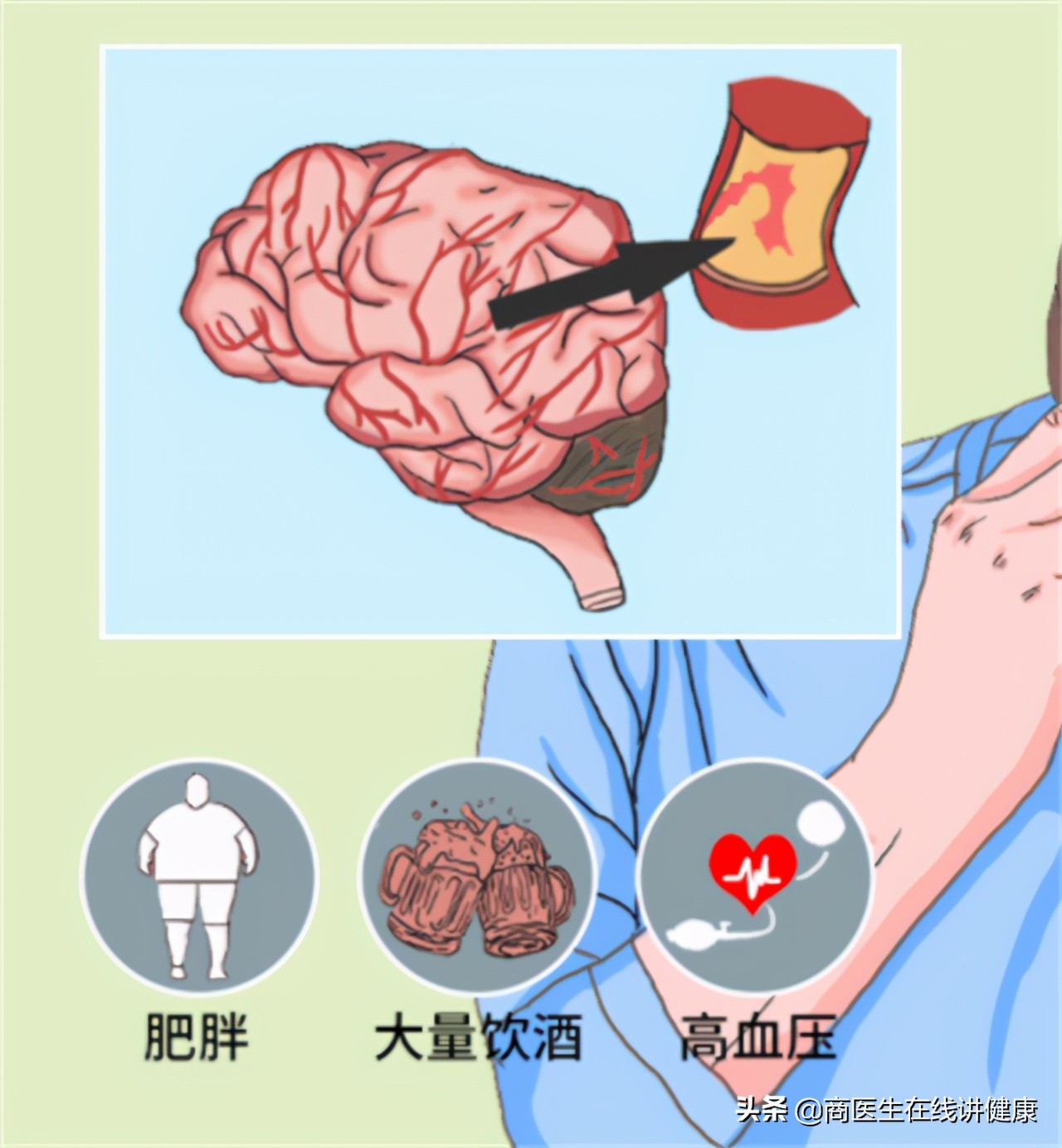 高血压吃降压药需要补充叶酸吗,高血压患者如何补充叶酸