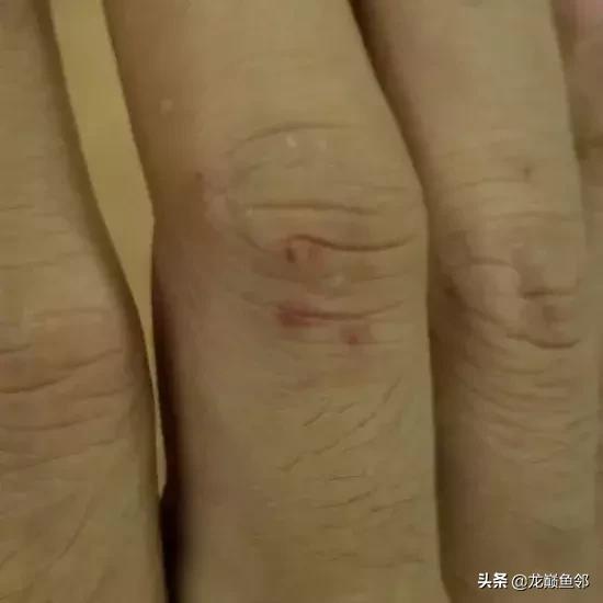 罗汉鱼的另类打开方式——爱您就给您痛的印记