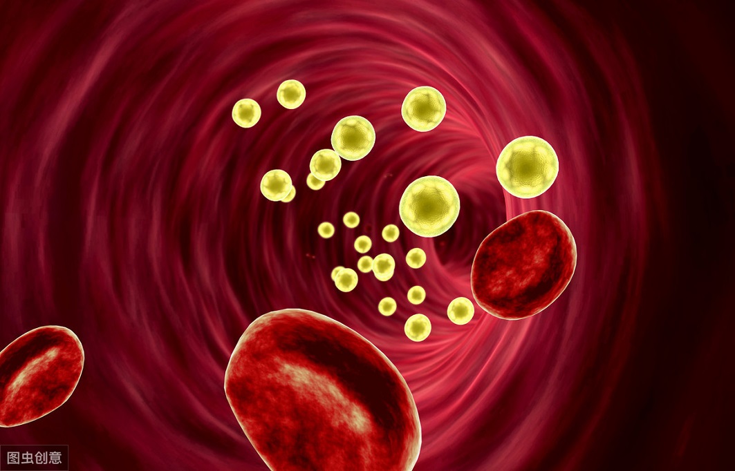 糖尿病下肢动脉硬化引起剧烈疼痛,糖尿病会引起下肢动脉血管闭塞症