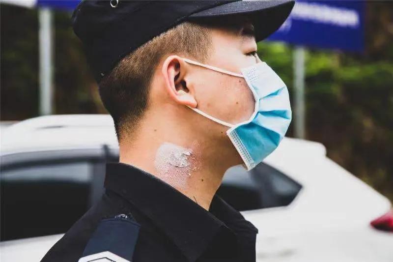 警犬与眼镜蛇搏斗不幸牺牲,边防警犬被眼镜蛇咬死